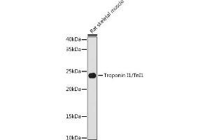 Western blot analysis of extracts of Rat skeletal muscle cells, using Troponin I1/TnI1 antibody (ABIN7270338) at 1:1000 dilution. (TNNI1 抗体)