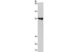 Gel: 6 % SDS-PAGE, Lysate: 40 μg, Lane: Human fetal brain tissue, Primary antibody: ABIN7191717(NRG3 Antibody) at dilution 1/200, Secondary antibody: Goat anti rabbit IgG at 1/8000 dilution, Exposure time: 2 minutes (Neuregulin 3 抗体)