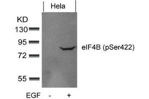Western blot analysis of extracts from Hela cells untreated or treated with EGF using eIF4B(phospho-Ser422) Antibody. (EIF4B 抗体  (pSer422))
