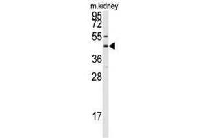 Image no. 1 for anti-Gap Junction Protein, alpha 8, 50kDa (GJA8) (C-Term) antibody (ABIN357099)