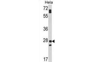 Western Blotting (WB) image for anti-Family with Sequence Similarity 3, Member B (FAM3B) antibody (ABIN3002861) (FAM3B 抗体)