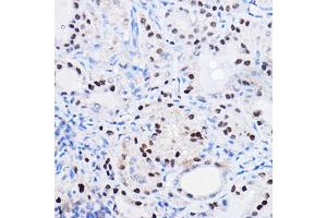 Immunohistochemistry (IHC) image for anti-SRY (Sex Determining Region Y)-Box 9 (SOX9) (AA 100-200) antibody (ABIN1682861)