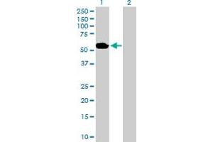 Western Blot analysis of ABLIM1 expression in transfected 293T cell line by ABLIM1 MaxPab polyclonal antibody. (ABLIM1 抗体  (AA 1-401))