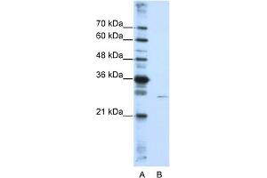 WB Suggested Anti-EMG1 Antibody Titration:  0. (EMG1 抗体  (N-Term))
