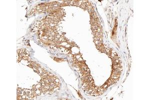 ABIN6267704 at 1/200 staining human testis tissue sections by IHC-P.