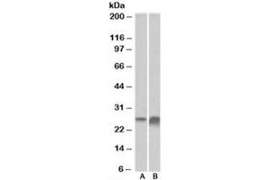 Western blot testing of human kidney [A] and liver [B] lysate with APOD antibody at 0. (Apolipoprotein D 抗体)