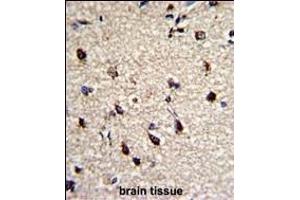 Immunohistochemistry (Paraffin-embedded Sections) (IHC (p)) image for anti-Dermatopontin (DPT) (AA 102-128) antibody (ABIN391701)