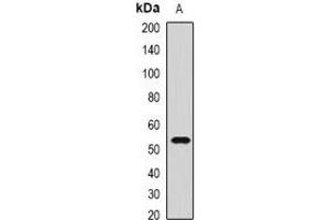 Western blot analysis of CMG2 expression in PC3 (A) whole cell lysates. (ANTXR2 抗体)