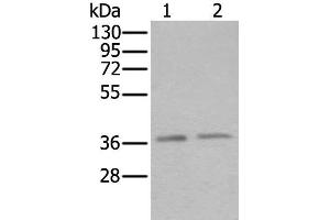 Western blot analysis of Hela and Raji cell lysates using ATXN7L3 Polyclonal Antibody at dilution of 1:500 (ATXN7L3 抗体)