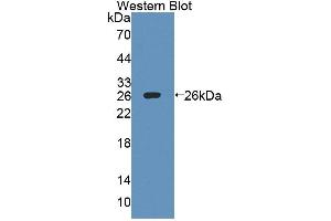Western blot analysis of the recombinant protein. (IL27 Receptor alpha 抗体  (AA 93-273))