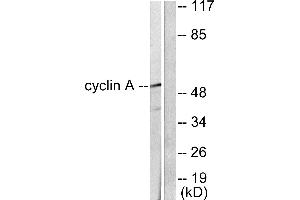 Western blot analysis of extracts from COS7 cells, using Cyclin A antibody (#C0165). (Cyclin A 抗体)