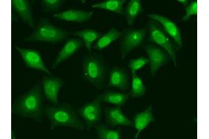 Immunofluorescence analysis of HeLa cells using TREX1 antibody (ABIN5974106). (TREX1 抗体)