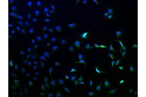 Immunofluorescence staining of A549 cells with ABIN7144159 at 1:100, counter-stained with DAPI. (ANKRD5 抗体  (AA 411-698))