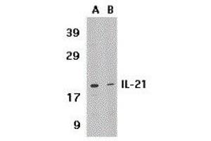 Western Blotting (WB) image for anti-Interleukin 21 (IL21) (Center) antibody (ABIN2474977)