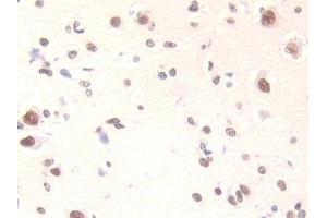 Detection of FAM19A3 in Human Brain Tissue using Polyclonal Antibody to Family With Sequence Similarity 19, Member A3 (FAM19A3)