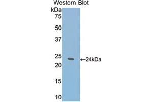 Western blot analysis of the recombinant protein. (Thrombospondin 1 抗体  (AA 61-259))