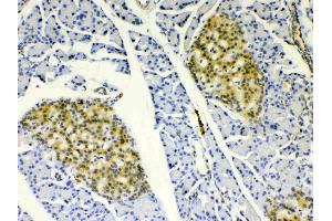 IHC analysis of HSPB8/Hsp22 using anti- HSPB8/Hsp22 antibody . (HSPB8 抗体  (AA 1-196))