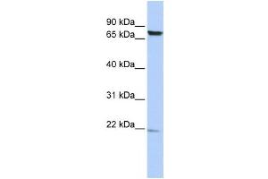 Western Blotting (WB) image for anti-Chromosome 7 Open Reading Frame 38 (C7orf38) antibody (ABIN2459912) (FAM200A 抗体)