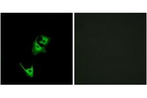 Immunofluorescence analysis of HeLa cells, using GLP1R Antibody. (GLP1R 抗体  (AA 101-150))