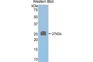 Detection of Recombinant PRLR, Rat using Polyclonal Antibody to Prolactin Receptor (PRLR) (Prolactin Receptor 抗体  (AA 20-229))