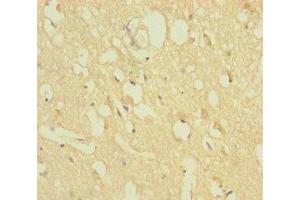 Immunohistochemistry of paraffin-embedded human brain tissue using ABIN7176279 at dilution of 1:100 (ZNF396 抗体  (AA 1-200))