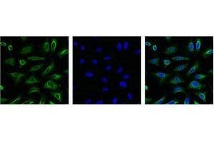 IF analysis of Hela with antibody (Left) and DAPI (Right) diluted at 1:100. (Aquaporin 4 抗体)