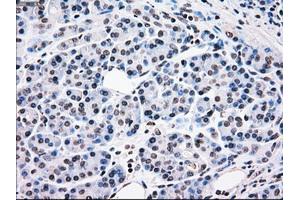 Image no. 2 for anti-B-Raf proto-oncogene, serine/threonine kinase (BRAF) antibody (ABIN1496954) (BRAF 抗体)
