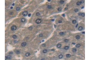 Detection of ALDH1A1 in Human Liver Tissue using Polyclonal Antibody to Aldehyde Dehydrogenase 1 Family, Member A1 (ALDH1A1)