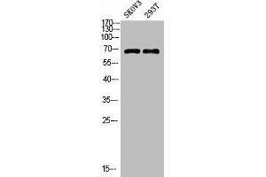 Western blot analysis of MOUSE-BRAIN lysate, antibody was diluted at 1000. (GADD34 抗体  (AA 430-490))