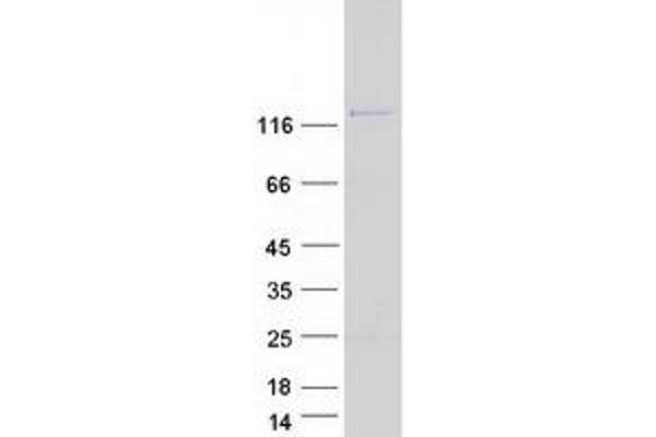 DGKD Protein (Transcript Variant 2) (Myc-DYKDDDDK Tag)