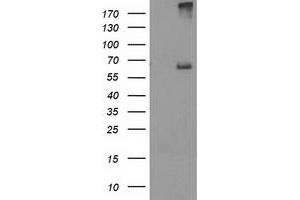 Western Blotting (WB) image for anti-Ribophorin 1 (RPN1) antibody (ABIN1500755) (RPN1 抗体)
