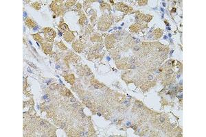Immunohistochemistry of paraffin-embedded Human stomach using BEST1 Polyclonal Antibody at dilution of 1:100 (40x lens). (Bestrophin 1 抗体)