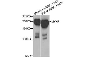 Western blot analysis of extracts of mouse skeletal muscle and rat skeletal muscle cell lines, using MYH7 antibody. (MYH7 抗体)