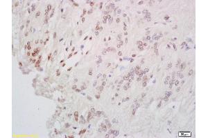 Immunohistochemistry (IHC) image for anti-cAMP Responsive Element Binding Protein 1 (CREB1) (AA 101-150) antibody (ABIN723965)