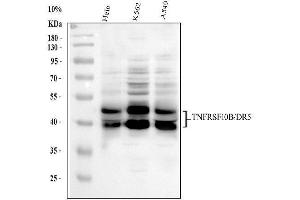 Western blot analysis of DR5 using anti-DR5 antibody (ABIN5518794).