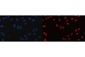 IF analysis of CPSF6 using anti-CPSF6 antibody (ABIN7601897).