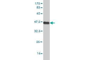 Western Blot detection against Immunogen (38. (FGFR1 抗体  (AA 31-150))