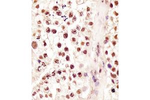 (ABIN6244063 and ABIN6578228) staining RBMX in human testis tissue sections by Immunohistochemistry (IHC-P - paraformaldehyde-fixed, paraffin-embedded sections). (RBMX 抗体  (AA 262-294))