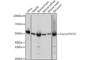 Western blot analysis of extracts of various cell lines, using Fascin/FSCN1 Rabbit mAb (ABIN7267142) at 1:1000 dilution.