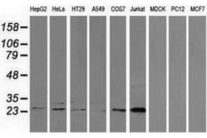 Western blot analysis of extracts (35 µg) from 9 different cell lines by using anti-CLPP monoclonal antibody. (CLPP 抗体)