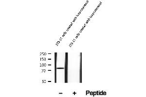 anti-Lipase, Hormone-Sensitive (LIPE) (pSer563) antibody