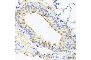 Immunohistochemistry of paraffin-embedded mouse lung using BGLAP antibody (ABIN5975009) at dilution of 1/100 (40x lens). (Osteocalcin 抗体)