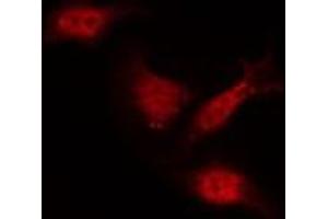 ABIN6267555 staining NIH-3T3 by IF/ICC.