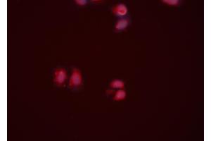 ABIN6274217 staining HeLa cells by ICC/IF. (APEX1 抗体  (N-Term))