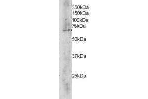 ABIN184688 staining (4 ug/ml) of Human Brain lysate (RIPA buffer, 35 ug total protein per lane). (TBL1X 抗体  (C-Term))