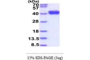 SDS-PAGE (SDS) image for CD247 Molecule (CD247) (AA 52-164) protein (His tag) (ABIN6388182) (CD247 Protein (AA 52-164) (His tag))