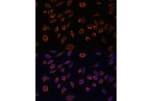Immunofluorescence analysis of L929 cells using NTPCR antibody (ABIN7269059) at dilution of 1:100. (C1orf57 抗体  (AA 91-190))