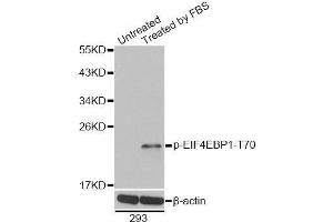 Western blot analysis of extracts of 293 cells, using Phospho-EIF4EBP1-T70 antibody. (eIF4EBP1 抗体  (pThr70))