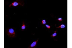 IF analysis of DARS2 using anti-DARS2 antibody (ABIN6719279).