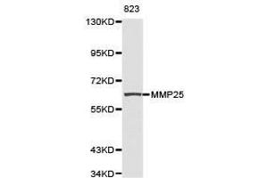 Western Blotting (WB) image for anti-Matrix Metallopeptidase 25 (MMP25) antibody (ABIN1873725) (MMP25 抗体)